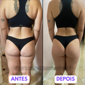 Antes - 3