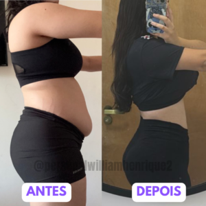 Antes - 34