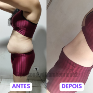 Antes - 7